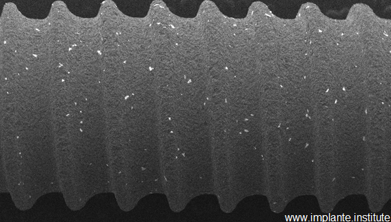 Contaminação com alumínio em pontos brancos na superfície.