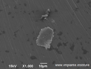 Imagem sugestiva contendo manchas escuras como corrosão vindo de dentro e na superfície em cinza, alumínio.