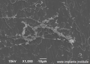 Imagem sugestiva de cabelo jateado com alumínio na superfície do implante.