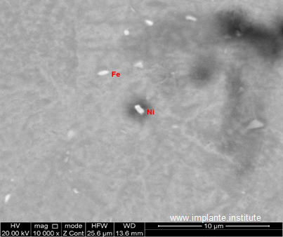 Contaminação contendo Níquel e Ferro no interior de um implante.